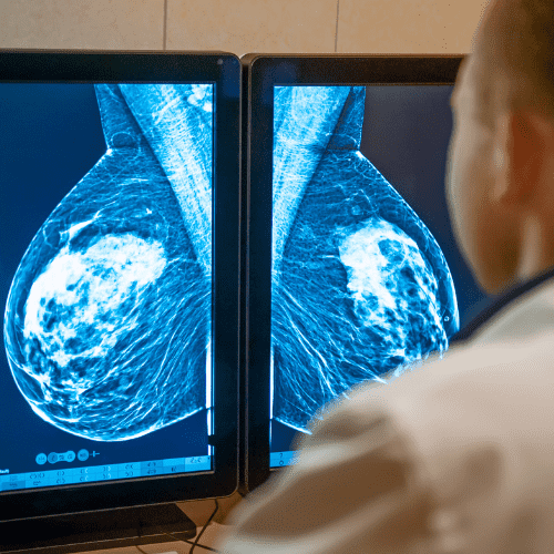 best mammography jammu