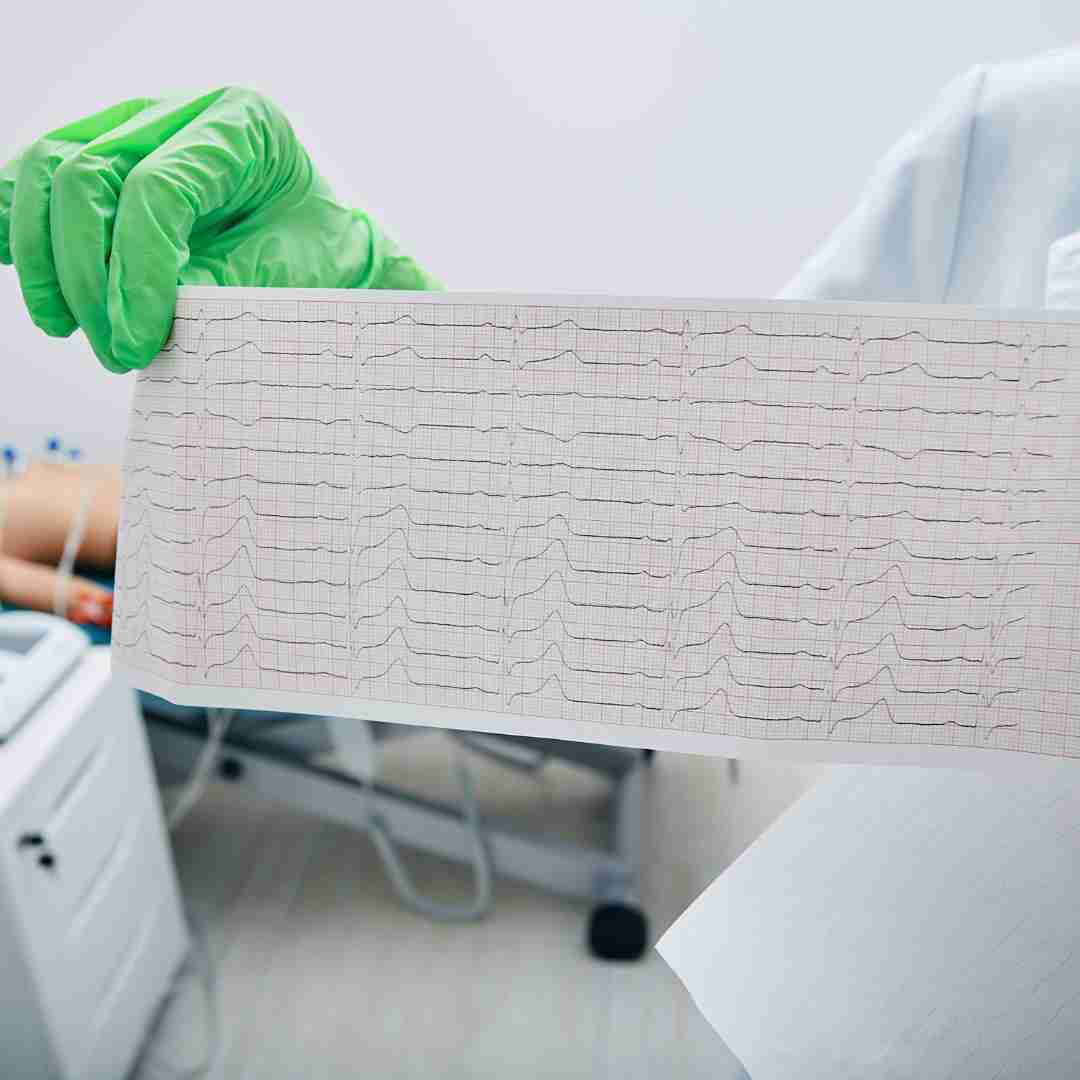 best ECG TEST in JAMMU